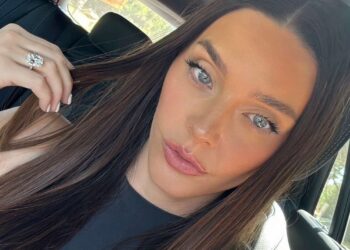 So entfernen Sie Hyperpigmentierung im Mundbereich: Profi-Tipps