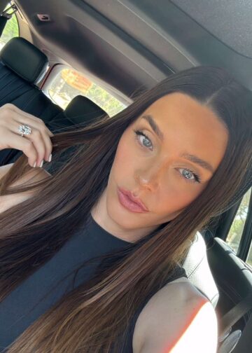 So entfernen Sie Hyperpigmentierung im Mundbereich: Profi-Tipps